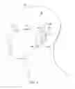 Fig. 09 - Surgical method for implantable neurostimulation system for pain
