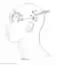 Fig. 10 - Surgical method for implantable neurostimulation system for pain