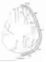 Fig. 16 - Surgical method for implantable neurostimulation system for pain