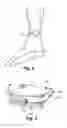 Fig. 06 - Devices, systems, and methods for improving pelvic floor dysfunction