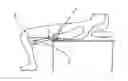 Fig. 01 - Portable back traction device and method of use