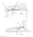 Fig. 02 - Portable back traction device and method of use