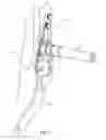 Fig. 02 - Inertial breakover mechanism