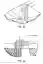 Fig. 03 - LEAF AND DEBRIS FILTER FOR SWIMMING POOL