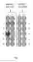 Fig. 02 - DEPDC1-derived peptide and vaccine containing same