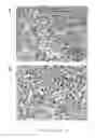 Fig. 07 - Method for treating myelofibrosis comprising administering a transforming growth factor beta type II receptor antagonist