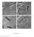 Fig. 09 - Method for treating myelofibrosis comprising administering a transforming growth factor beta type II receptor antagonist