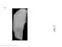 Fig. 03 - Nanosilica dispersion lost circulation material (LCM)