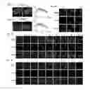 Fig. 02 - COMPOSITIONS AND METHODS FOR THE MODULATION OF DNA DAMAGE RESPONSES USING BAL1 AND BBAP