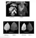 Fig. 01 - OVEREXPRESSION OF PLANT GENES INVOLVED IN PROGRAMMED CELL DEATH FOR YIELD INCREASE