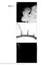 Fig. 14 - OVEREXPRESSION OF PLANT GENES INVOLVED IN PROGRAMMED CELL DEATH FOR YIELD INCREASE