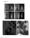 Fig. 15 - OVEREXPRESSION OF PLANT GENES INVOLVED IN PROGRAMMED CELL DEATH FOR YIELD INCREASE