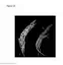 Fig. 19 - OVEREXPRESSION OF PLANT GENES INVOLVED IN PROGRAMMED CELL DEATH FOR YIELD INCREASE