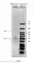 Fig. 03 - Ligase-assisted nucleic acid circularization and amplification