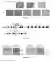 Fig. 19 - METHODS FOR DIAGNOSING AND TREATING FOLLICULAR LYMPHOMA