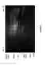 Fig. 10 - Glucose sensors and methods of use thereof