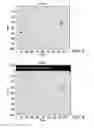 Fig. 03 - Detection and quantification of proppant for optimized fracture treatment design in in-fill and new wells