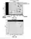Fig. 06 - Detection and quantification of proppant for optimized fracture treatment design in in-fill and new wells