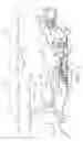 Fig. 02 - INVESTMENT CASTING CORE