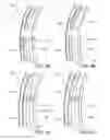 Fig. 06 - Clamp