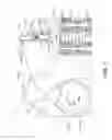 Fig. 02 - Hydraulic lash adjuster