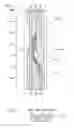 Fig. 04 - Variable valve-operating device
