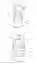 Fig. 06 - Reciprocating Pump Having a Combination Check Valve and Relief Valve