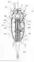 Fig. 01 - Line strainer