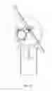 Fig. 31 - Balanced solar tracker clamp