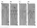 Fig. 01 - Methods for detecting novel autoantibodies in Crohn's disease