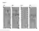 Fig. 02 - Methods for detecting novel autoantibodies in Crohn's disease
