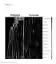 Fig. 07 - Methods for detecting novel autoantibodies in Crohn's disease