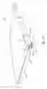 Fig. 03 - Hinge including a lock