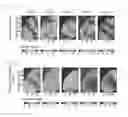 Fig. 14 - Ensemble-based reservoir characterization method using multiple Kalman gains and dynamic data selection