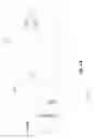 Fig. 13 - Tool for visualizing PCR results