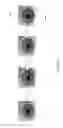 Fig. 04 - Image processing method and system for iris recognition