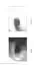 Fig. 04 - Image processing method and system for iris recognition