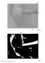Fig. 04 - Device and method for automatically detecting a surgical tool on an image provided by a medical imaging system