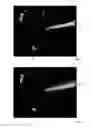 Fig. 05 - Device and method for automatically detecting a surgical tool on an image provided by a medical imaging system