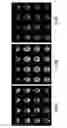 Fig. 07 - Vascular territory segmentation using mutual clustering information from image space and label space