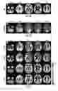 Fig. 08 - Vascular territory segmentation using mutual clustering information from image space and label space