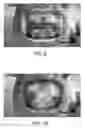 Fig. 07 - Object digitization
