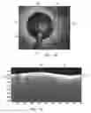 Fig. 03 - Systems and methods to detect and display endovascular features