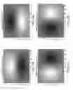Fig. 04 - Systems and methods to detect and display endovascular features
