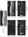 Fig. 07 - Systems and methods to detect and display endovascular features