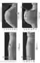 Fig. 08 - Systems and methods to detect and display endovascular features