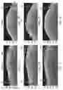 Fig. 09 - Systems and methods to detect and display endovascular features