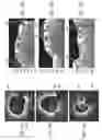 Fig. 11 - Systems and methods to detect and display endovascular features