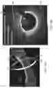 Fig. 14 - Systems and methods to detect and display endovascular features
