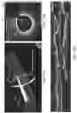 Fig. 15 - Systems and methods to detect and display endovascular features